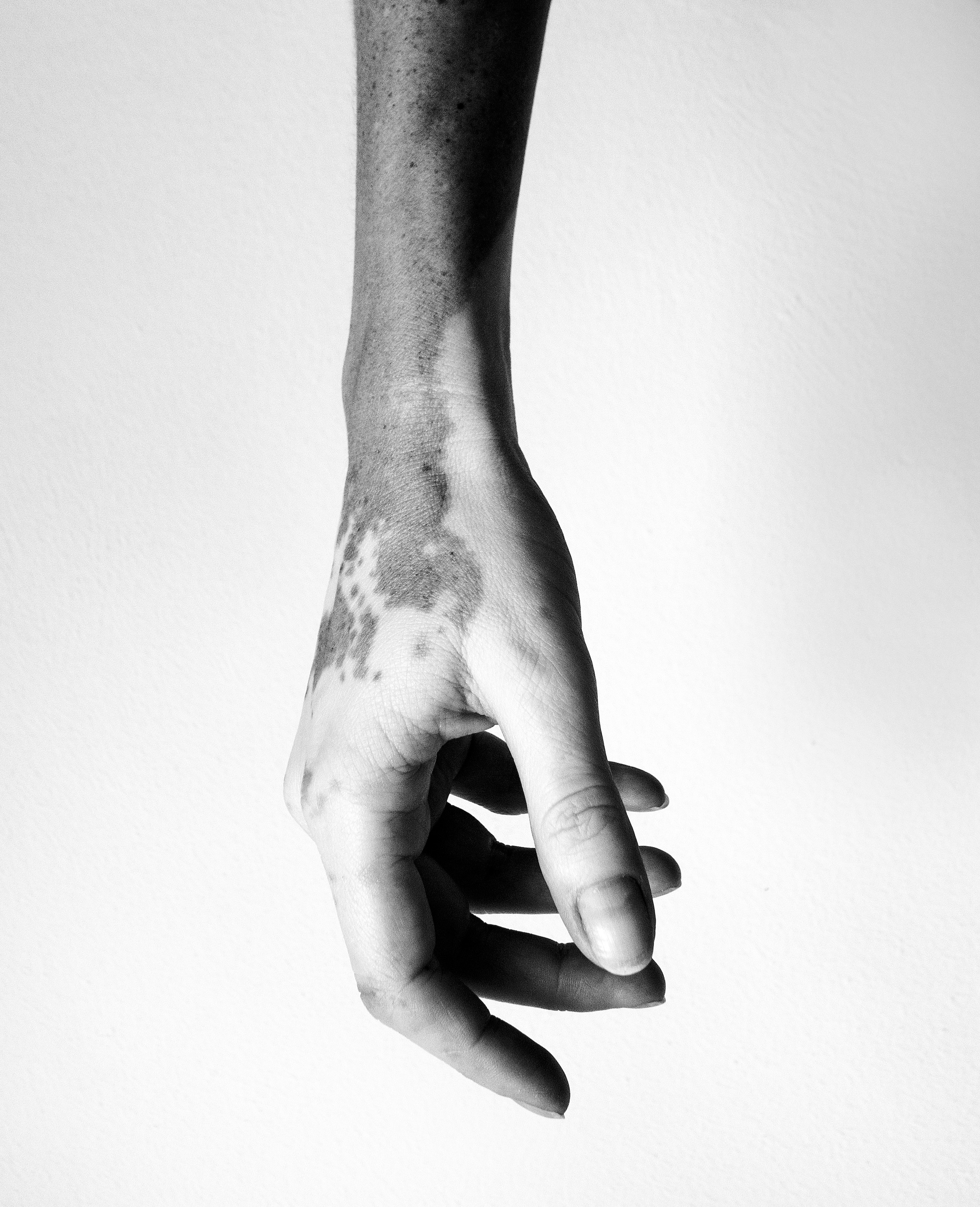De perfecte imperfecties van mensen in beeld gebracht | Het Parool