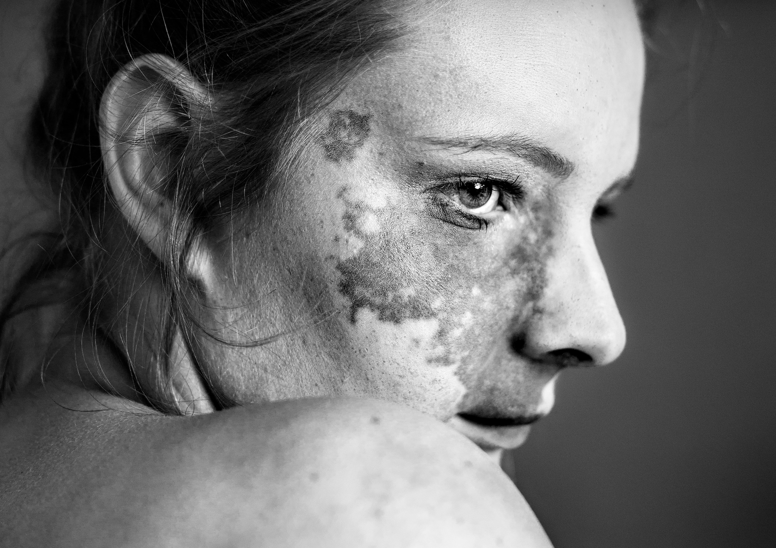 De perfecte imperfecties van mensen in beeld gebracht | Het Parool