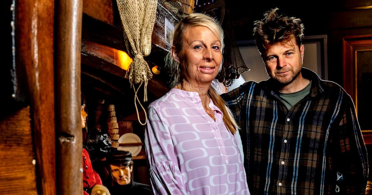 Marga Veerman-Smit was 14 en voor 78 procent verbrand na de nieuwjaarsramp in Volendam: ‘Dachten dat