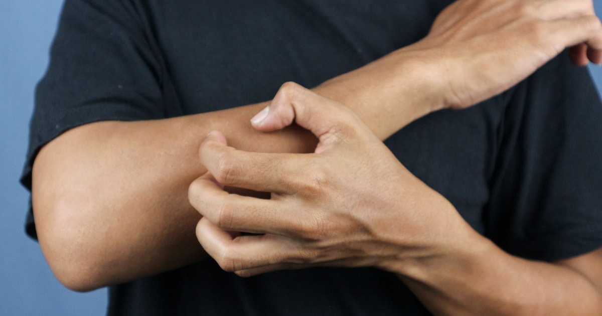 Landelijk onderzoek om schurftmijt terug te dringen: ‘Er is heel weinig research en ontwikkeling gew