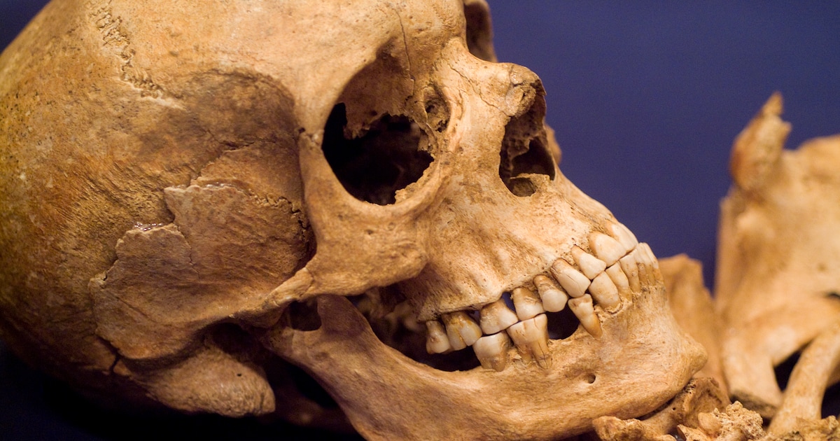 Schedels opgegraven bij werkzaamheden Hortusplantsoen in Amsterdam-Centrum: ‘Deze omgeving is heel b